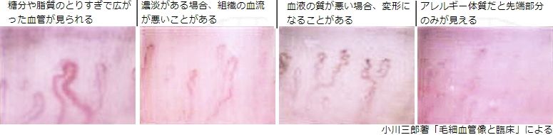 血流スコープ( 血流観察装置)MJ-BL10 Jスコープ がおすすめ｜株式会社 