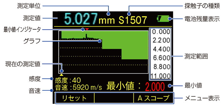 Bスコープ表示