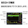 Bスコープ表示