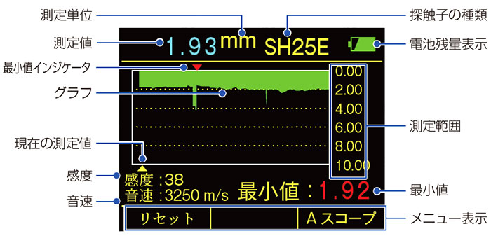 Bスコープ表示