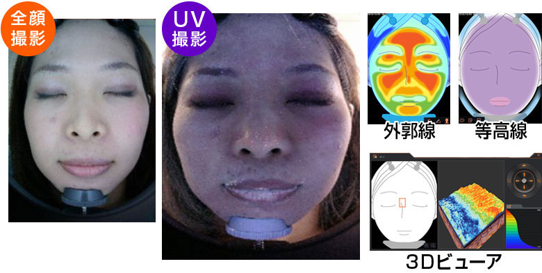 ウッドランプ全顔肌診断システム A-ONE Simple（エイ・ワン・シンプル）