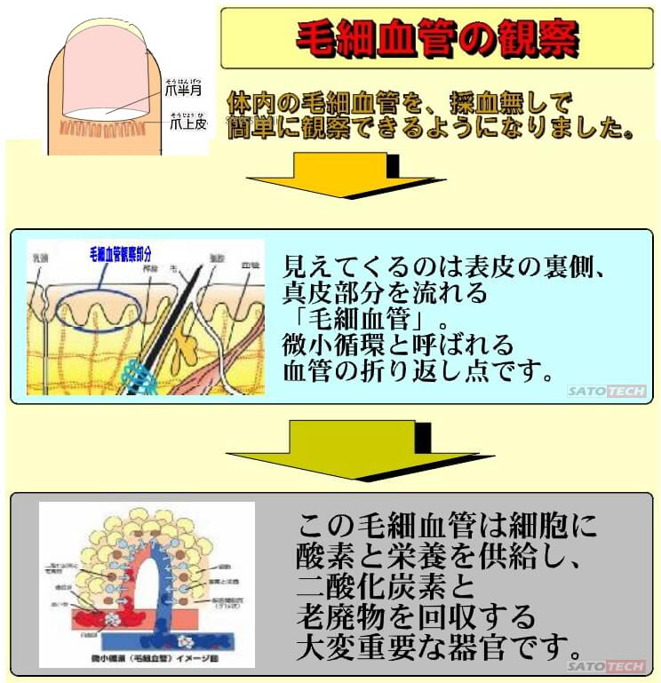 20万円以上の製品と同スペック【送料無料】血流スコープ(ゴースト血管スコープ)