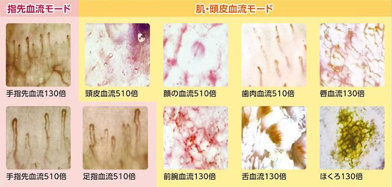 毛細血管スコープ 血流スコープ 指 血管 血流-